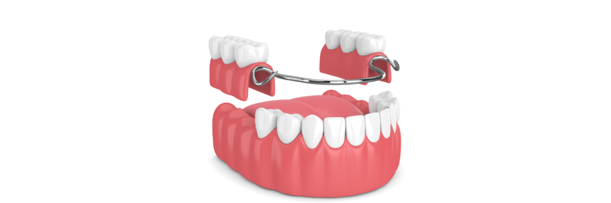 Top Tip When Choosing Dentures