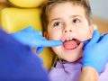 Baby Tooth Extraction